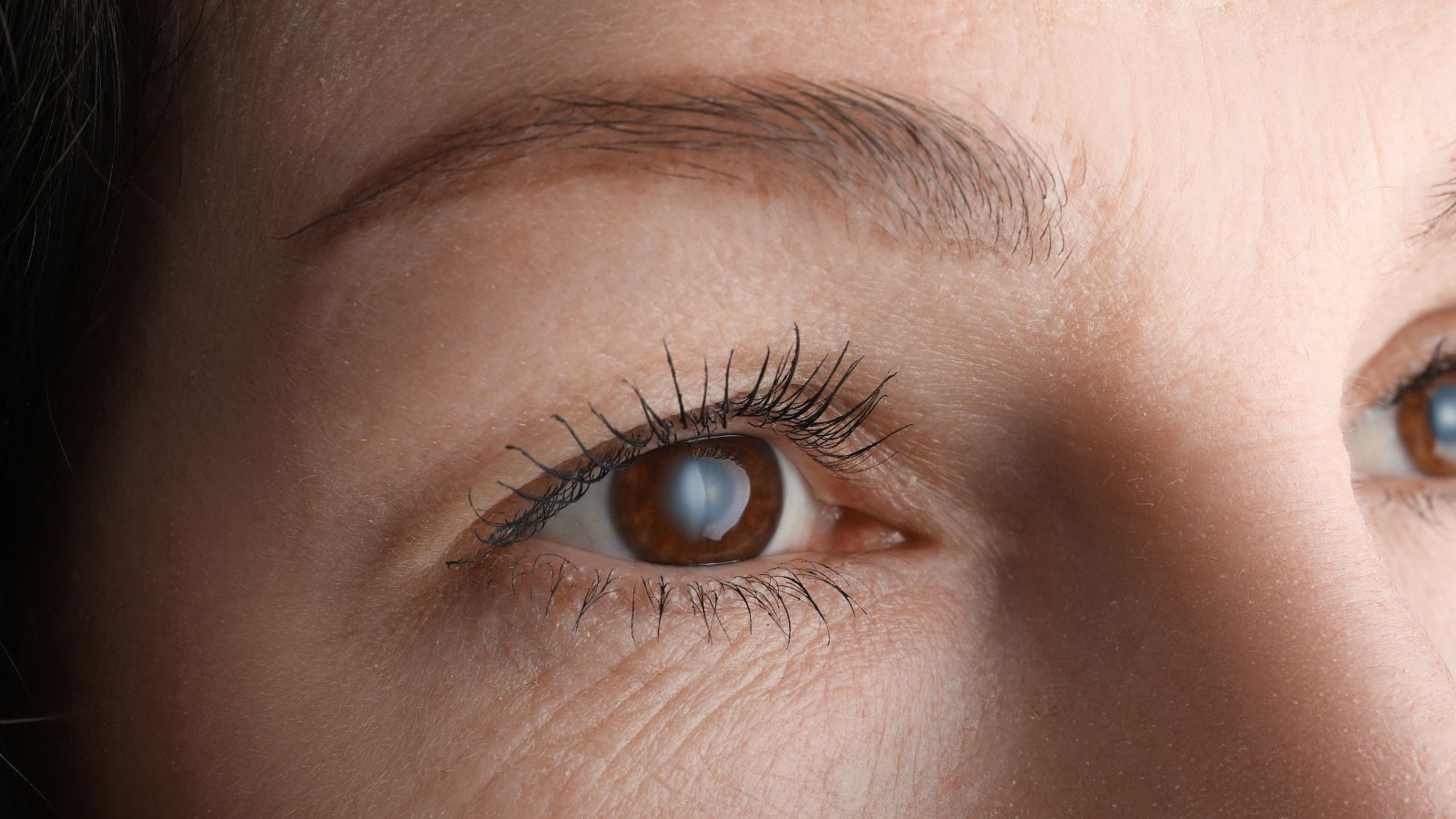 白内障を疑うべき症状一覧｜見逃しやすいサインと受診の目安