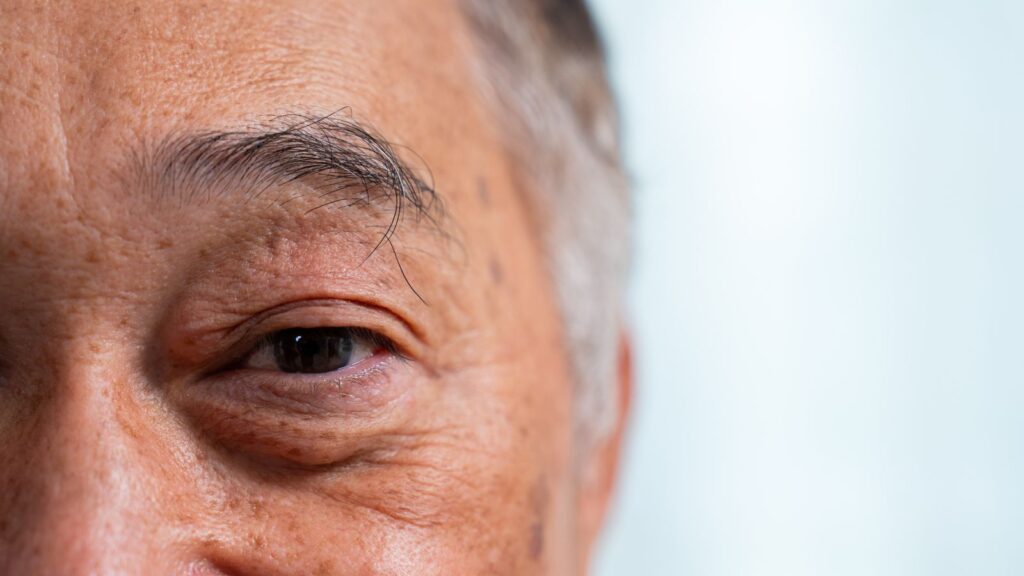 白内障手術で視力が上がらない理由と、乱視矯正で改善できること