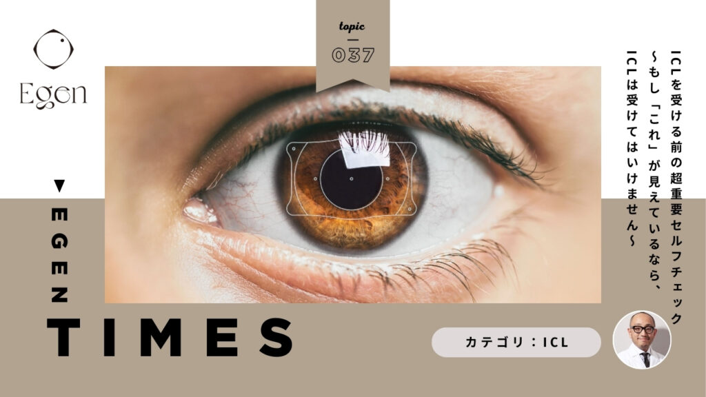 ICLを受ける前の超重要セルフチェック